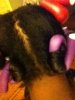 backscalp.jpg