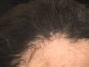 Scalp Damage010.jpg