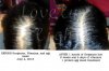 before and after 1 month.jpg